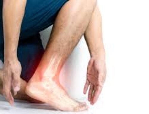 Dolore esterno alla caviglia: conosci i muscoli peronieri?
